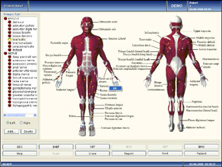 EMG Software